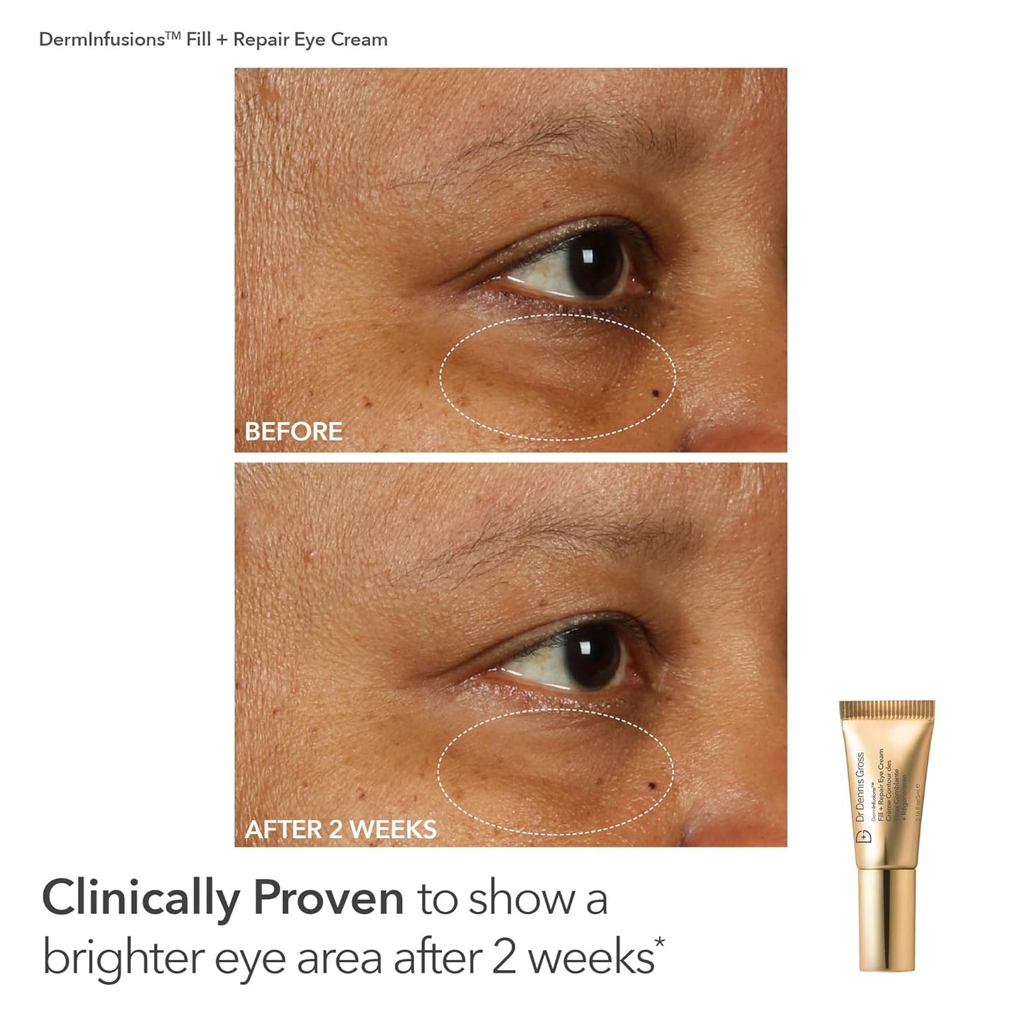 Dr. Dennis Gross Fill, Plump & Firm Kit – DermInfusions™ Hyaluronic Acid Serum, Eye Cream & Lip Treatment | Boost Hydration, Smooth Fine Lines & Enhance Volume | Limited Edition Gift Set